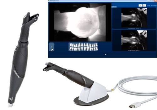 KaVo Diagnocam 2170 - Aпарат за лазерна диагностика на Кариес
