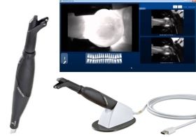 KaVo Diagnocam 2170 - Aпарат за лазерна диагностика на Кариес